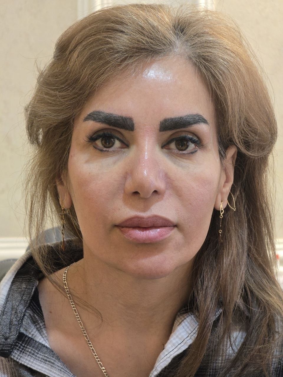 عکسِ نمونه‌ی موقت